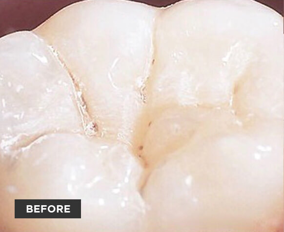 before dentistry