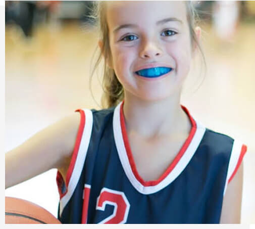 mouth guards
